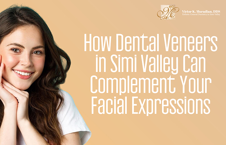 How Dental Veneers in Simi Valley Can Complement Your Facial Expressions